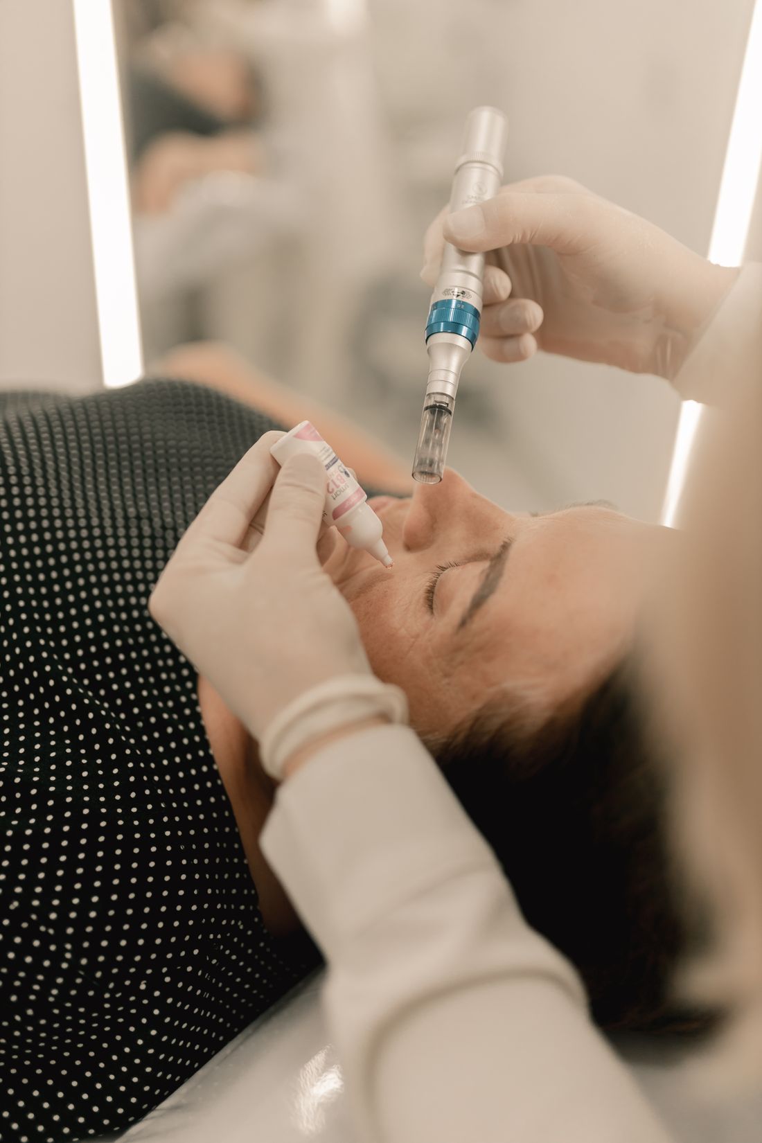 RF microneedling в The House by tOuch®